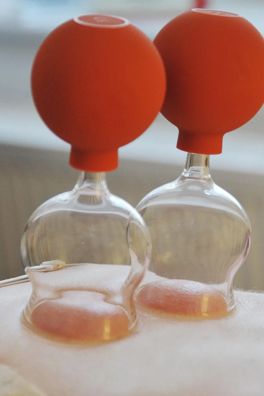 Ventosas (Cupping Therapy) fuenlabrada